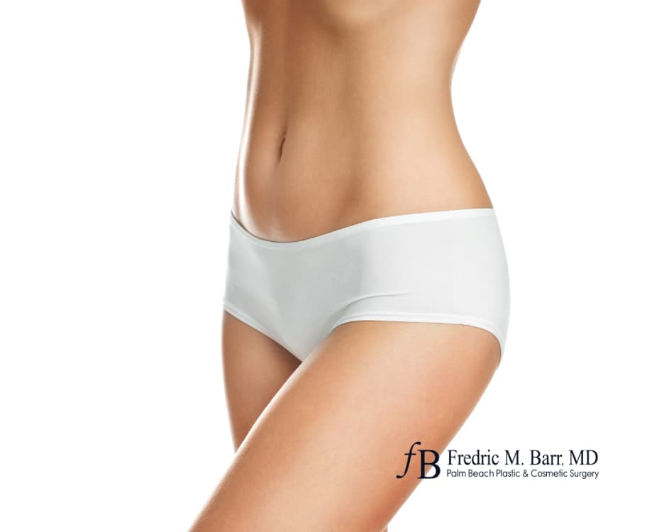 Liposuction in Florida Your Key to a Sculpted Look This Summer and All Year Round | Call (561) 833-4122